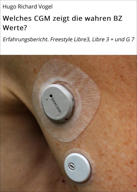 Welches CGM zeigt die wahren BZ Werte? - Hugo Richard Vogel