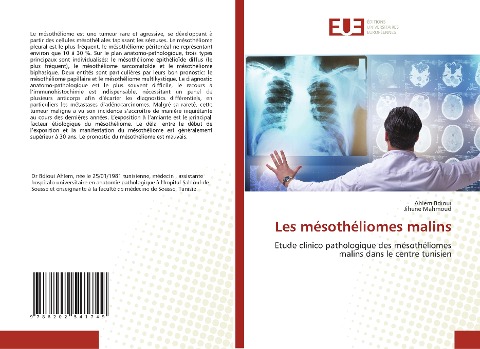 Les mésothéliomes malins - Ahlem Bdioui, Jihene Mahmoud