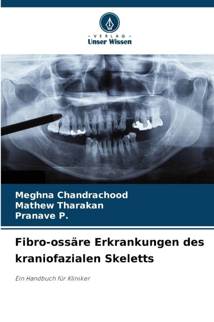 Fibro-ossäre Erkrankungen des kraniofazialen Skeletts - Meghna Chandrachood, Mathew Tharakan, Pranave P.
