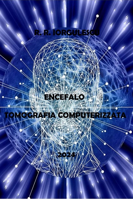 Encefalo - Tomografia Computerizzata - R. R. Iorgulescu