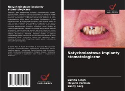 Cover-Bild zum Titel 'Natychmiastowe implanty stomatologiczne' von 'Sumita Singh, Mayank Vermani, Sunny Garg'