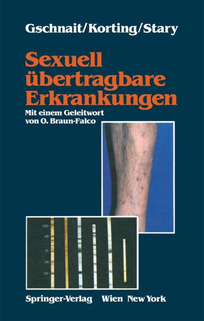 Sexuell übertragbare Erkrankungen - Fritz Gschnait, Angelika Stary, Hans C. Korting