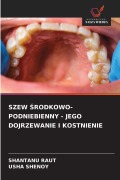Cover-Bild zum Titel 'SZEW ¿RODKOWO-PODNIEBIENNY - JEGO DOJRZEWANIE I KOSTNIENIE' von 'Shantanu Raut, Usha Shenoy'