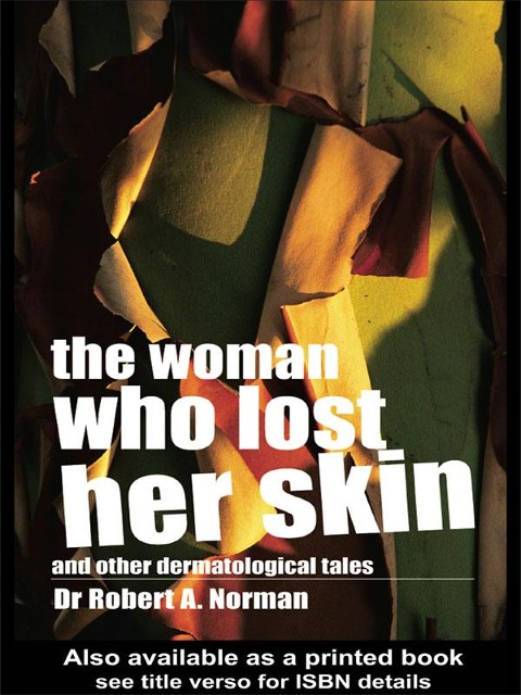 The Woman Who Lost Her Skin - Rob Norman