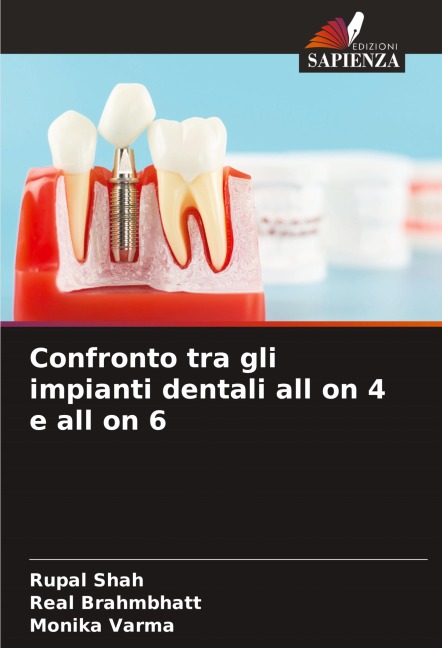 Confronto tra gli impianti dentali all on 4 e all on 6 - Rupal Shah, Real Brahmbhatt, Monika Varma