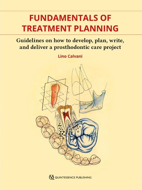 Fundamentals of Treatment Planning - Lino Calvani