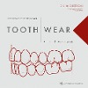  Tooth Wear