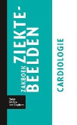 Cover-Bild zum Titel 'Zakboek Ziektebeelden Cardiologie' von 'Karin Linden'