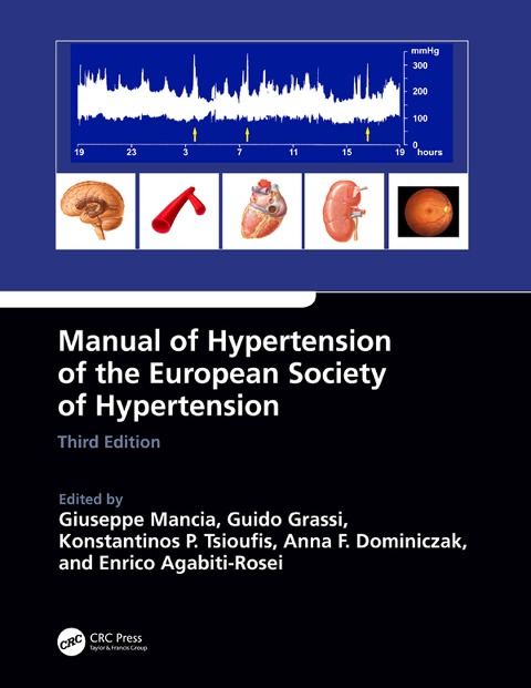 Manual of Hypertension of the European Society of Hypertension, Third Edition - 