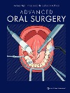 Advanced Oral Surgery