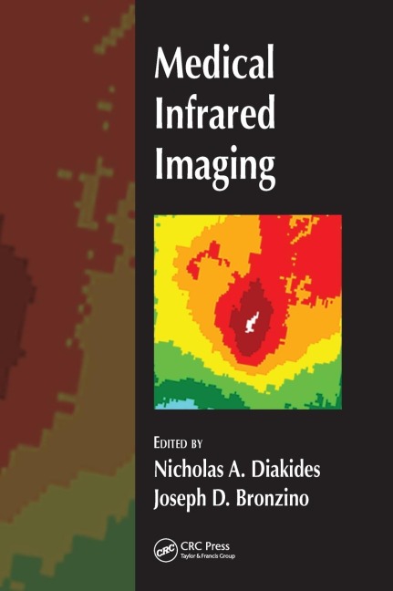 Medical Infrared Imaging - Nicholas A. Diakides, Joseph D. Bronzino