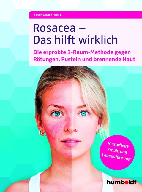Rosacea - Das hilft wirklich - Franziska Ring