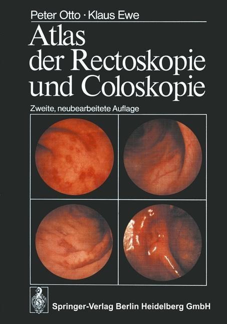 Atlas der Rectoskopie und Coloskopie - P. Otto, K. Ewe