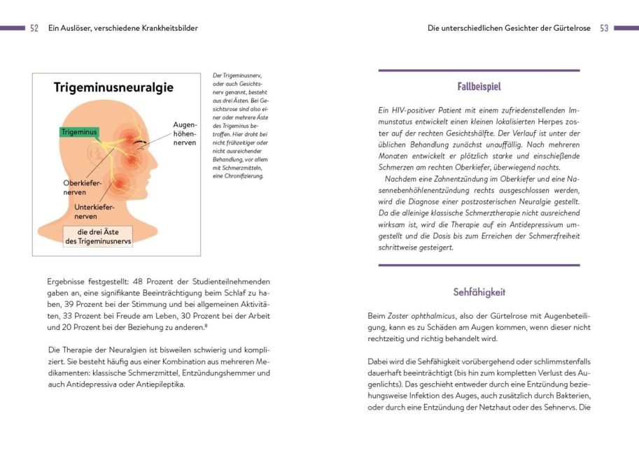 InsideView 4
