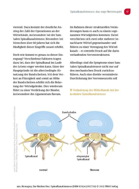 InsideView 12