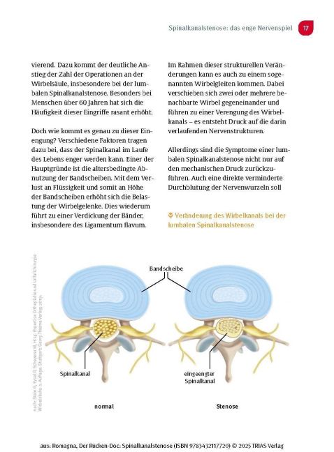 InsideView 12