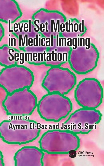 Level Set Method in Medical Imaging Segmentation - 
