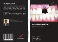 Cover-Bild zum Titel 'AWARIE IMPLANTÓW' von 'Akshay D. Joshi, Shweta A. Kolhe, Agrima Agrawal'