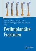 Periimplantäre Frakturen - 