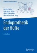 Cover-Bild zum Titel 'Endoprothetik der Hüfte' von ''
