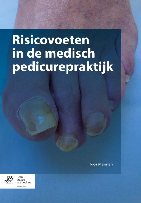 Risicovoeten in de medisch pedicurepraktijk - Toos Mennen