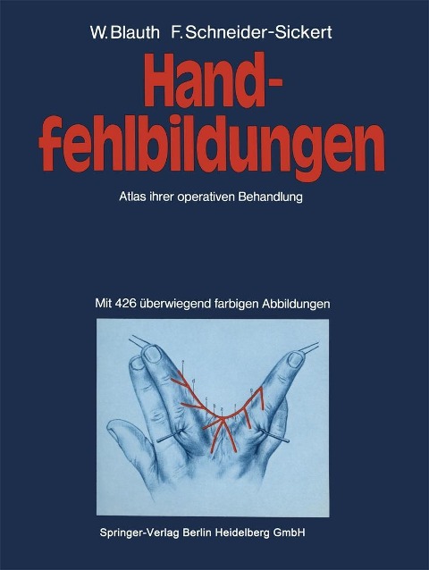 Handfehlbildungen - W. Blauth, F. Schneider-Sickert