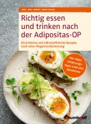 Cover-Bild zum Titel 'Richtig essen und trinken nach der Adipositas-OP' von 'Dipl. Oec. Troph. Anne Iburg'