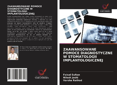 ZAAWANSOWANE POMOCE DIAGNOSTYCZNE W STOMATOLOGII IMPLANTOLOGICZNEJ - Faisal Sultan, Nilesh Joshi, Varsha Rathod