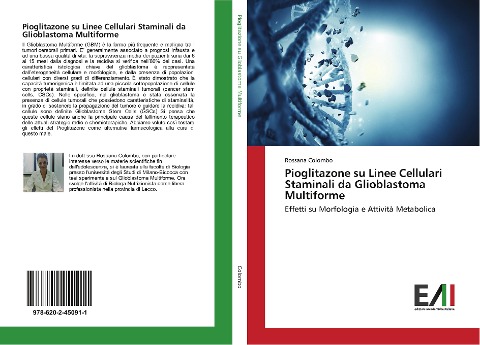 Pioglitazone su Linee Cellulari Staminali da Glioblastoma Multiforme - Rossana Colombo