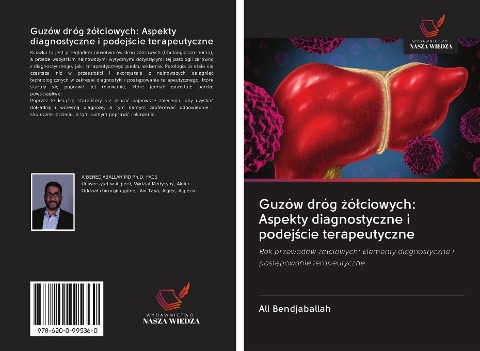 Guzów dróg ¿ó¿ciowych: Aspekty diagnostyczne i podej¿cie terapeutyczne - Ali Bendjaballah