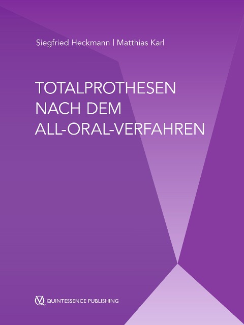 Totalprothesen nach dem All-Oral-Verfahren - Siegfried Heckmann, Matthias Karl