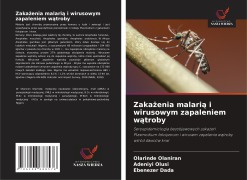 Cover-Bild zum Titel 'Zaka¿enia malari¿ i wirusowym zapaleniem w¿troby' von 'Olarinde Olaniran, Adeniyi Olusi, Ebenezer Dada'