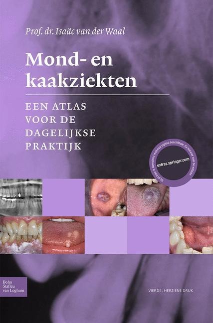 Mond- En Kaakziekten - I van der Waal