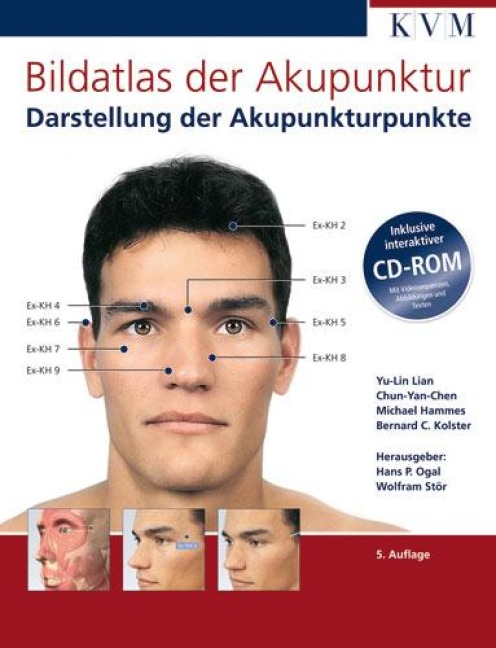 Bildatlas der Akupunktur - Yu-Lin Lian, Michael Hammes, Bernhard C. Kolster, Chun Yan-Chen