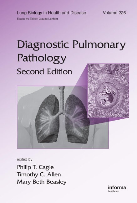 Diagnostic Pulmonary Pathology - 