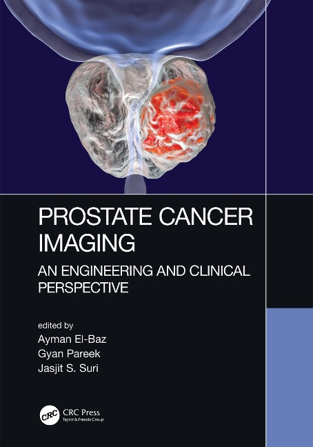 Prostate Cancer Imaging - 