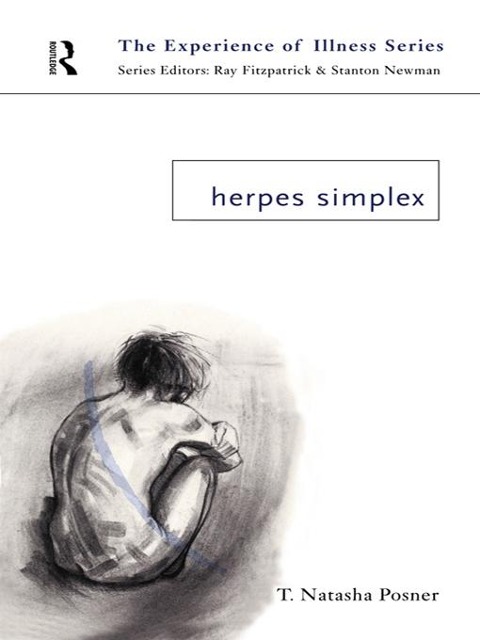 Herpes Simplex - T. Natasha Posner
