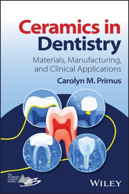Ceramics in Dentistry - Carolyn Primus