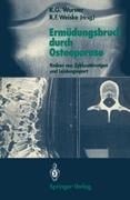 Ermüdungsbruch durch Osteoporose - 