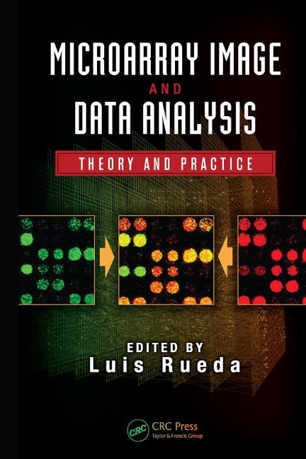 Microarray Image and Data Analysis - 