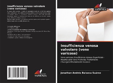 Insufficienza venosa valvolare (vene varicose) - Jonathan Andrés Balseca Suárez