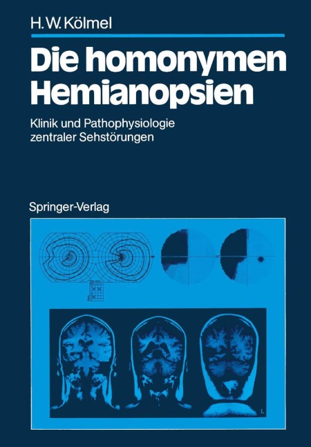 Die homonymen Hemianopsien - Hans W. Kölmel
