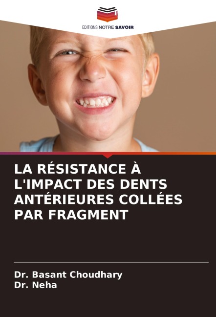 LA RÉSISTANCE À L'IMPACT DES DENTS ANTÉRIEURES COLLÉES PAR FRAGMENT - Basant Choudhary, Neha