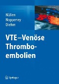 VTE - Venöse Thromboembolien - 