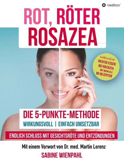 ROT RÖTER ROSAZEA - Sabine Wienpahl