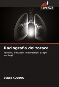 Cover-Bild zum Titel 'Radiografia del torace' von 'Lynda Aoudia'