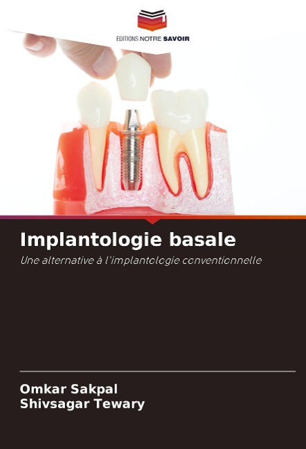 Implantologie basale - Omkar Sakpal, Shivsagar Tewary