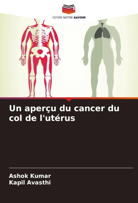Un aperçu du cancer du col de l'utérus - Ashok Kumar, Kapil Avasthi