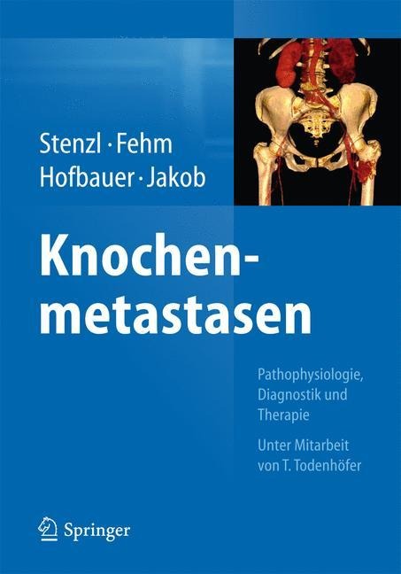 Knochenmetastasen - 