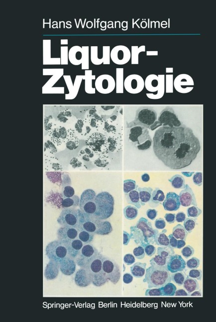 Liquor-Zytologie - H. W. Kölmel